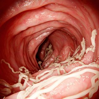 Befreiung von Parasiten